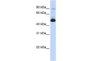 WB Suggested Anti-KRT16 Antibody Titration: 0. (KRT16 anticorps  (Middle Region))