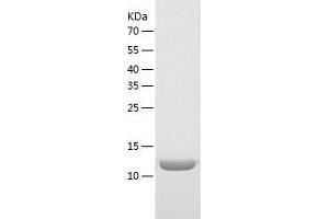 Western Blotting (WB) image for Interleukin 26 (IL26) (AA 22-171) protein (His tag) (ABIN7123582)