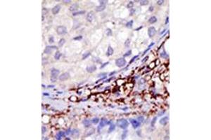 Image no. 2 for anti-Ring Finger Protein 216 (RNF216) (C-Term) antibody (ABIN357474)