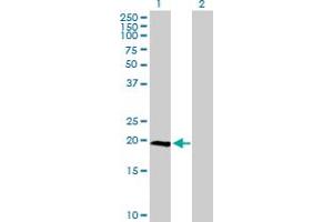 Western Blot analysis of IL23A expression in transfected 293T cell line by IL23A MaxPab polyclonal antibody. (IL23A anticorps  (AA 1-189))