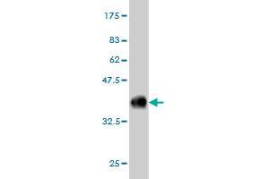 Western Blot detection against Immunogen (36. (COQ8A anticorps  (AA 1-100))