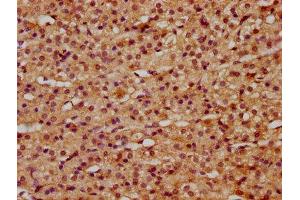 IHC image of ABIN7166985 diluted at 1:500 and staining in paraffin-embedded human adrenal gland tissue performed on a Leica BondTM system. (RILP anticorps  (AA 307-385))