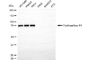 Western blotting analysis using forkhead box P1 antibody (ABIN7798650).