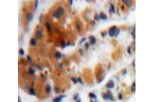 Used in DAB staining on fromalin fixed paraffin-embedded Stomach tissue