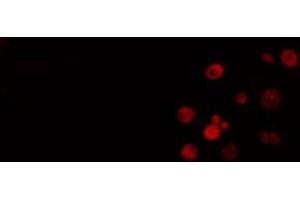 ABIN6274505 staining Hela cells by IF/ICC. (XRN2 anticorps  (N-Term))