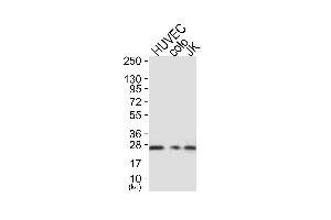 Western blot analysis of extracts from HUVEC cells (Lane 1), colo cells (Lane 2) and JK cells (Lane 3), using Caveolin-1 Antibody. (Caveolin-1 anticorps)