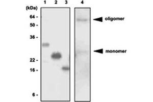 Western blot analysis of recombinant proteins and mouse liver lysates. (ADIPOQ anticorps  (AA 15-244))