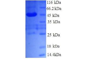 Transmembrane Emp24 Protein Transport Domain Containing 9 (TMED9) (AA 40-197), (partial) protein (GST tag)