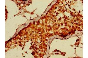 Immunohistochemistry of paraffin-embedded human testis tissue using ABIN7149691 at dilution of 1:100 (CDT2/RAMP anticorps  (AA 393-550))