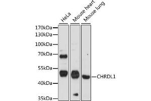 Western blot analysis of extracts of various cell lines, using CHRDL1 antibody (ABIN7266351) at 1:1000 dilution. (CHRDL1 anticorps  (AA 289-458))