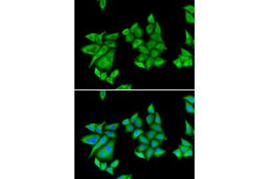 Immunofluorescence (IF) image for anti-Uroporphyrinogen Decarboxylase (UROD) antibody (ABIN1876681) (UROD anticorps)