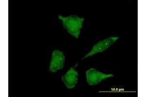 Immunofluorescence of purified MaxPab antibody to SIP1 on HeLa cell.
