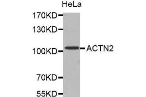 Western Blotting (WB) image for anti-Actinin, alpha 2 (ACTN2) (AA 1-250) antibody (ABIN1678557) (ACTN2 anticorps  (AA 1-250))