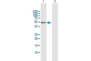 Western Blot analysis of PSMD5 expression in transfected 293T cell line by PSMD5 MaxPab polyclonal antibody.