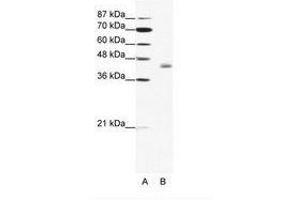 Image no. 1 for anti-LIM Domain Binding 2 (LDB2) (C-Term) antibody (ABIN202367) (LIM Domain Binding 2 Protein anticorps  (C-Term))