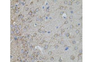 Immunohistochemistry of paraffin-embedded Mouse brain using MMP10 Polyclonal Antibody at dilution of 1:100 (40x lens).