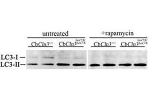 Immunoblots for LC3 protein (LC3B Antibody ) are shown for extracts from untreated or rapamycin-treated (250 nM, 4 h) cultures of wild-type (CbCln3+/+) or homozygous cerebellar cells (CbCln3Äex7/8/Äex7/8). (LC3B anticorps  (N-Term))