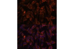 Immunofluorescence analysis of C6 cells using TLR3 antibody (ABIN6130066, ABIN6149219, ABIN6149220 and ABIN6215465) at dilution of 1:100.