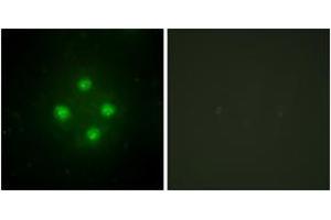 Immunofluorescence analysis of HuvEc cells, using MED24 Antibody. (MED24 anticorps  (AA 801-850))