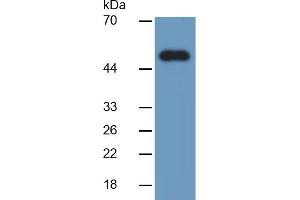 Rabbit Detection antibody from the kit in WB with Positive Control:  Sample Human liver lysate.