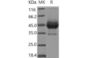 Western Blotting (WB) image for CD63 (CD63) protein (Fc Tag) (ABIN7321144) (CD63 Protein (CD63) (Fc Tag))