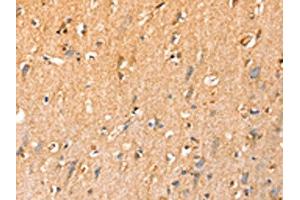 The image on the left is immunohistochemistry of paraffin-embedded Human brain tissue using ABIN7192442(SLC25A3 Antibody) at dilution 1/35, on the right is treated with synthetic peptide.