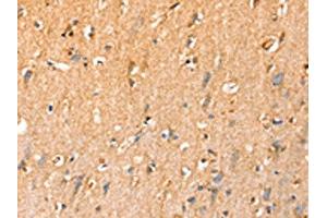 The image on the left is immunohistochemistry of paraffin-embedded Human brain tissue using ABIN7192442(SLC25A3 Antibody) at dilution 1/35, on the right is treated with synthetic peptide. (SLC25A3 anticorps)
