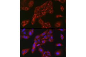 Immunofluorescence analysis of U-2 OS cells using FBP1 Rabbit pAb (ABIN6130385, ABIN6140501, ABIN6140502 and ABIN6221054) at dilution of 1:100 (40x lens). (FBP1 anticorps  (AA 1-338))