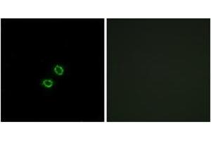 Immunofluorescence analysis of A549 cells, using KIR2DL5B Antibody. (KIR2DL5B anticorps  (AA 161-210))