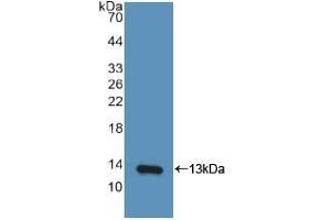 Detection of Recombinant IP10, Human using Polyclonal Antibody to Interferon Gamma Induced Protein 10 kDa (IP10) (CXCL10 anticorps  (AA 22-98))