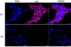 Immunocytochemical staining of HeLa cells using CAD antibody (ABIN7797866), 1:1,000), Top panel: wild-type (WT), Bottom panal: CAD shRNA knockdown (KD). (Recombinant CAD anticorps)