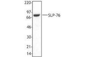 Image no. 1 for anti-Lymphocyte Cytosolic Protein 2 (SH2 Domain Containing Leukocyte Protein of 76kDa) (LCP2) (AA 216-434) antibody (ABIN230462)