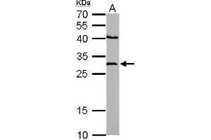 WB Image NQO1 antibody [C2C3], C-term detects NQO1 protein by Western blot analysis.