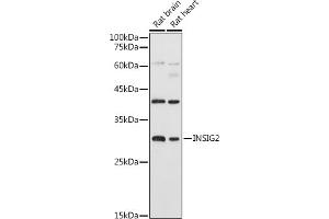 Western blot analysis of extracts of various cell lines, using INSIG2 antibody (ABIN7267888) at 1:1000 dilution. (INSIG2 anticorps  (AA 50-150))