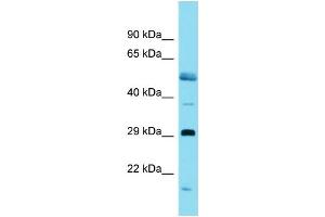Host:  Rabbit  Target Name:  Ovol1  Sample Type:  Rat Pancreas lysates  Antibody Dilution:  1. (OVOL1 anticorps  (C-Term))