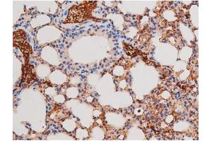 ABIN6267487 at 1/200 staining Mouse lung tissue sections by IHC-P.