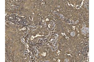 IHC analysis of EIF5 using anti-EIF5 antibody (ABIN7599722). (EIF5 anticorps  (AA 11-423))