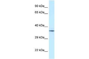 WB Suggested Anti-NUDT6 Antibody Titration: 1. (NUDT6 anticorps  (Middle Region))