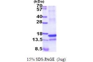 SDS-PAGE (SDS) image for Regenerating Islet-Derived Family, Member 4 (REG4) (AA 23-158) protein (His tag) (ABIN5854108)
