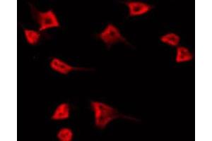 ABIN6266909 staining HT29 by IF/ICC.