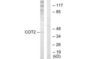 Western Blotting (WB) image for anti-Grr1p (GRR1) (N-Term) antibody (ABIN1849262) (Grr1p anticorps  (N-Term))