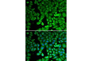 Immunofluorescence analysis of U2OS cells using NR4A1 antibody (ABIN6293398). (NR4A1 anticorps)