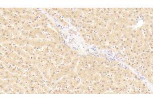 Detection of GTF2H1 in Human Liver Tissue using Polyclonal Antibody to General Transcription Factor IIH Subunit 1 (GTF2H1)