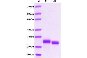 Interleukin 6 (IL6) (AA 25-211) (Active) protein (His tag)