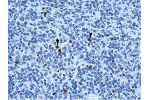 Image no. 1 for anti-Annexin A3 (ANXA3) (N-Term) antibody (ABIN202243)