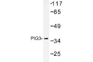 Image no. 1 for anti-Tumor Protein P53 Inducible Protein 3 (TP53I3) antibody (ABIN272242) (TP53I3 anticorps)
