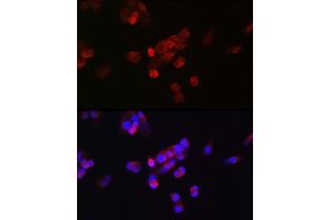 Immunofluorescence analysis of HepG2 cells using FGF23 antibody (ABIN6127894, ABIN6140600, ABIN6140602 and ABIN6221721) at dilution of 1:25.