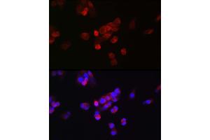 Immunofluorescence analysis of HepG2 cells using FGF23 antibody (ABIN6127894, ABIN6140600, ABIN6140602 and ABIN6221721) at dilution of 1:25. (FGF23 anticorps  (AA 25-251))