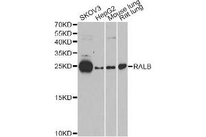 Western blot analysis of extracts of various cell lines, using RALB antibody (ABIN6293713) at 1:1000 dilution. (RALB anticorps)