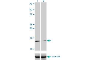 Western blot analysis of B2M over-expressed 293 cell line, cotransfected with B2M Validated Chimera RNAi (Lane 2) or non-transfected control (Lane 1).